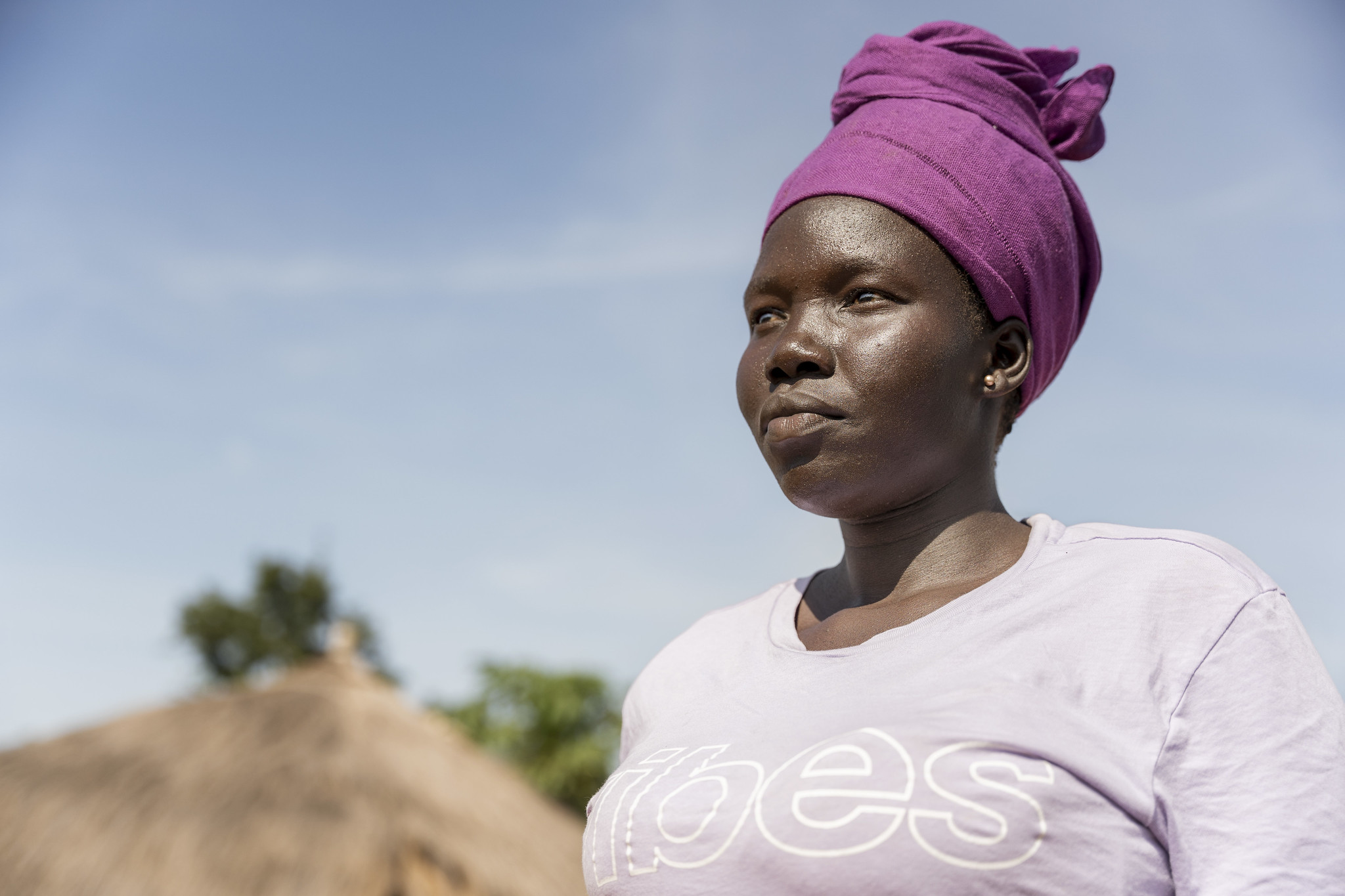 From GBV Survivor to Advocate: Nolah Sunday Leads Change in Imvempi Settlement